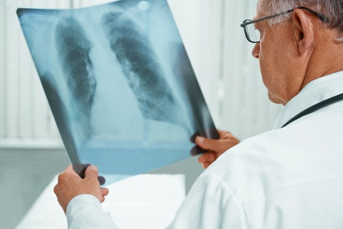 24. března: světový den boje proti tuberkulóze